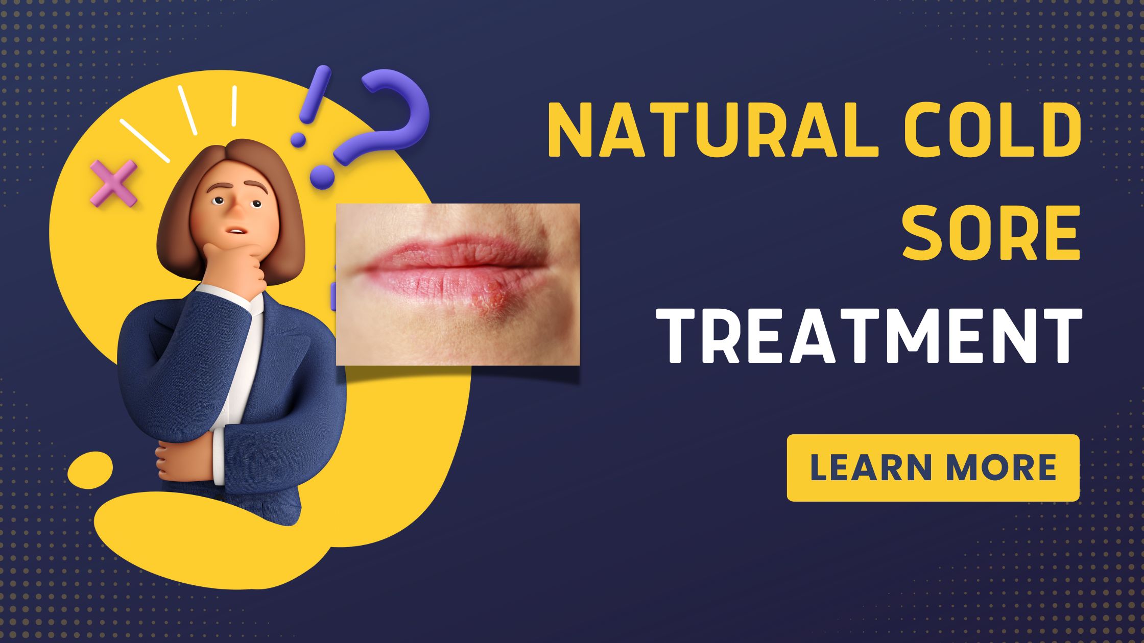 Natural Cold Sore Treatment