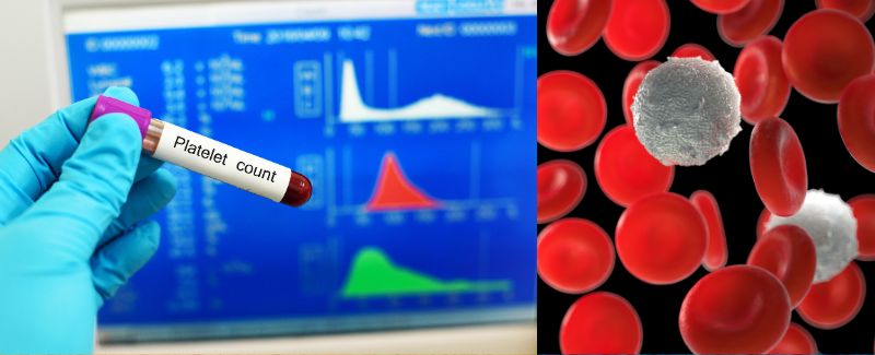 Low Blood Platelet Counts