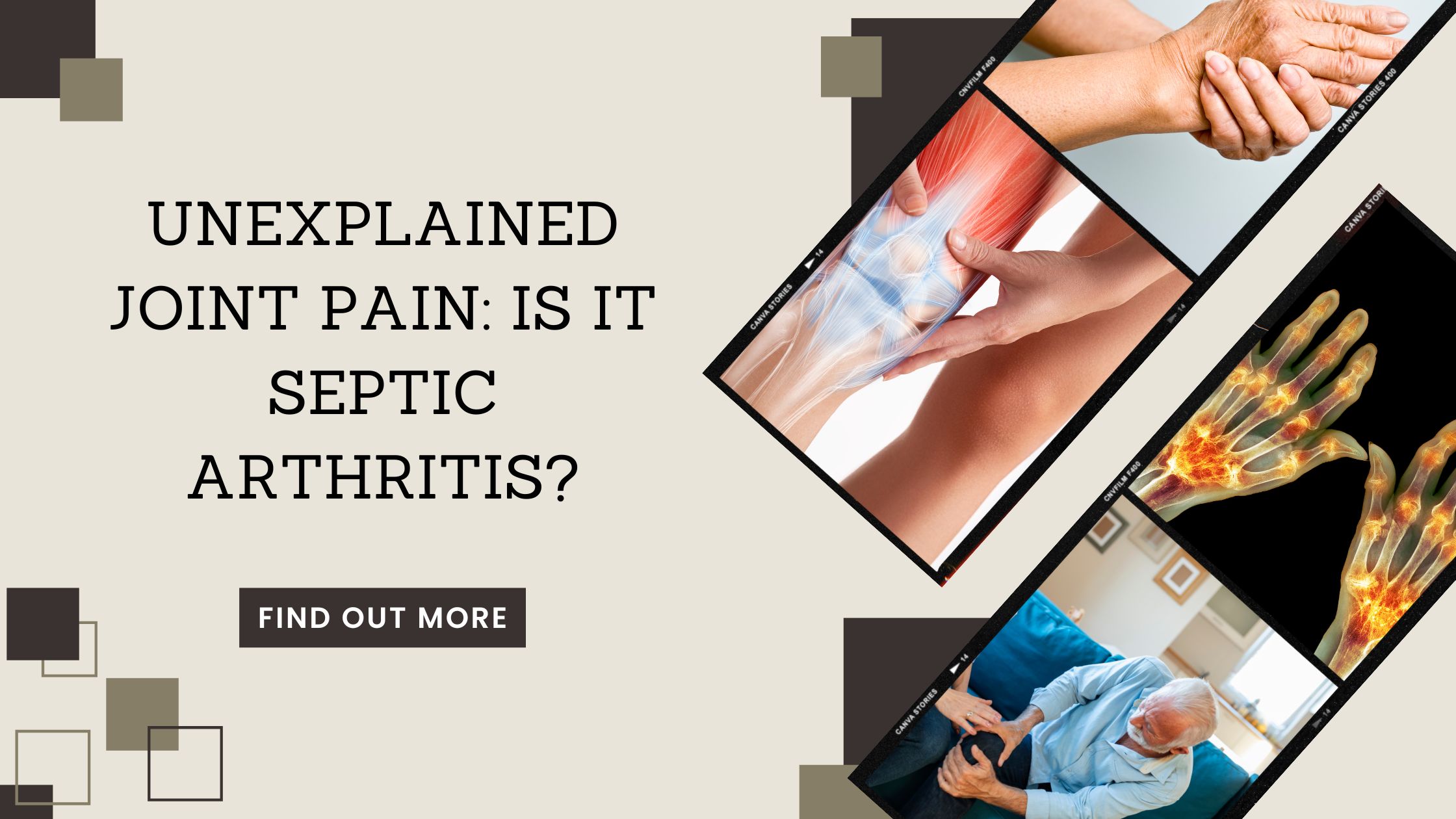 Unexplained Joint Pain: Is It Septic Arthritis?