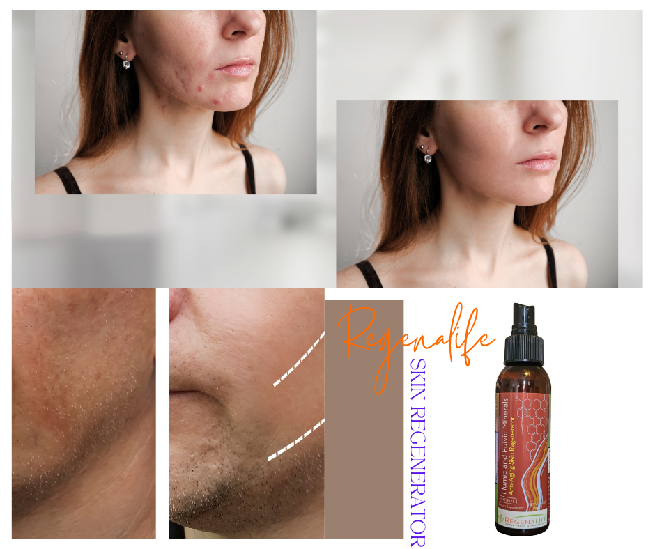 The Science of Skin Regeneration: What Happens When Your Skin Heals