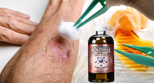 Heal Faster: How Colloidal Silver Can Help with Burns and Wound Care