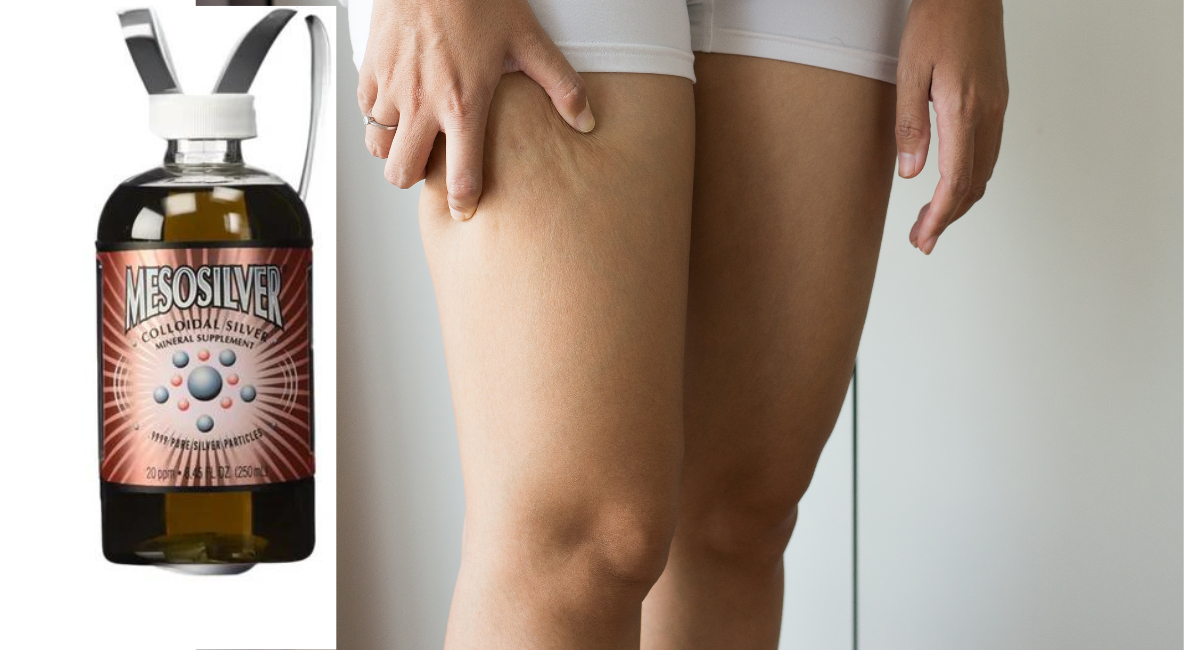 Colloidal Silver for Cellulitis: A Natural Remedy for Skin Infections