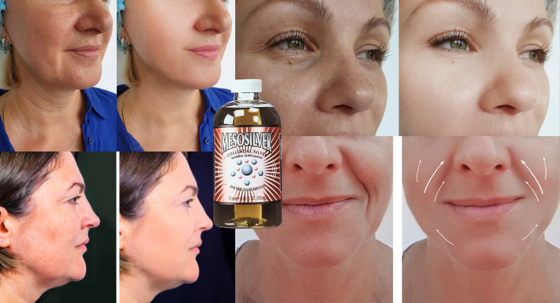 Clear Your Skin Naturally: How Colloidal Silver Can Help Fight Acne