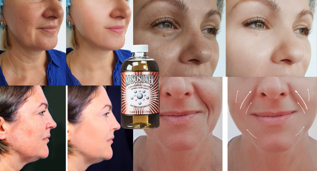 Soothe Your Skin: How Colloidal Silver Helps Relieve Eczema and Skin Irritations Naturally