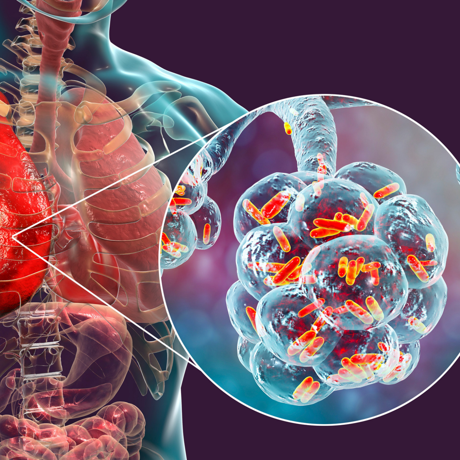 Upper Respiratory Infections