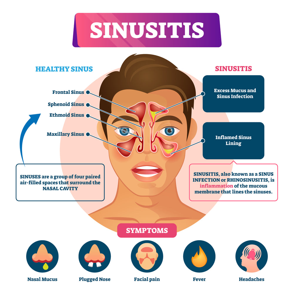 Sinus Infection MesoSilver