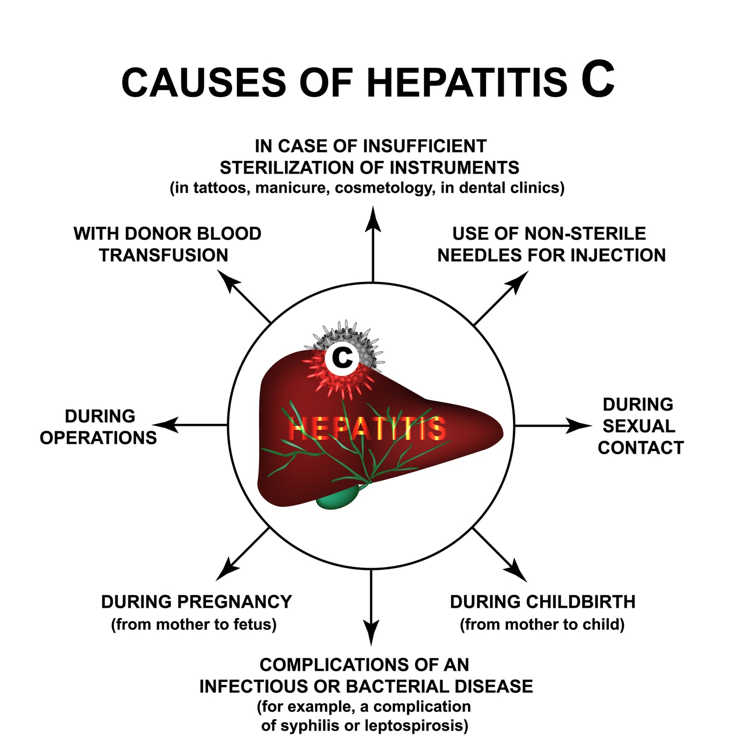 Hepatitis C Infection Causes